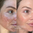 Óleo de Girassol Ozonizado 100% Natural Para peles sensíveis, inflamadas ou com manchas que não respondem a produtos comuns